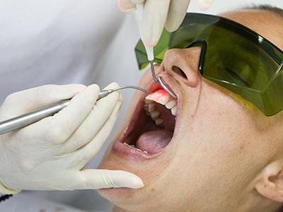 Granger Dentistry | Dental Cleanings, Dental Fillings and Dermal Fillers